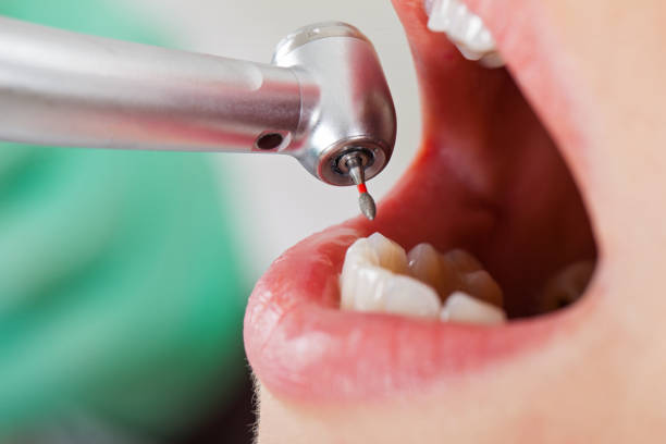 Best Broken Tooth Emergency  in Naranja, FL